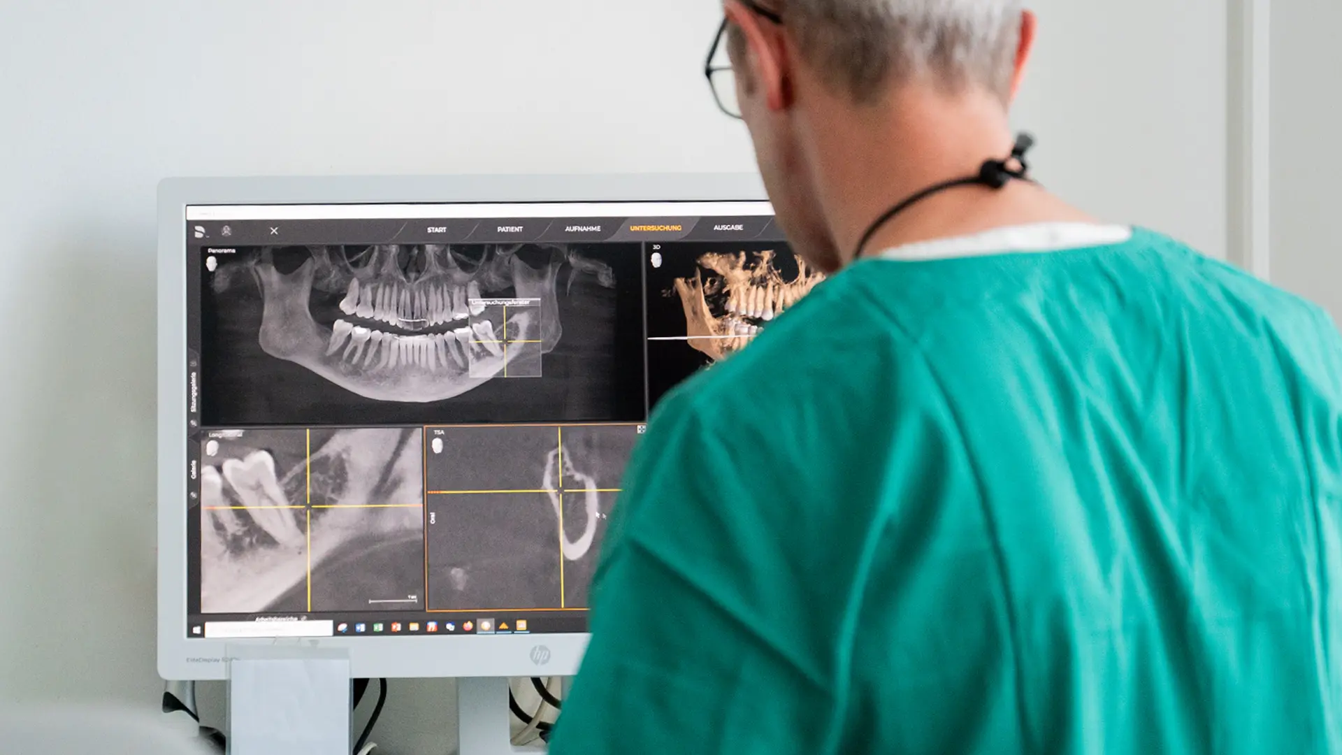 Präzision in 3D: Moderne Diagnostik mit digitaler Volumentomographie (DVT) in Köln