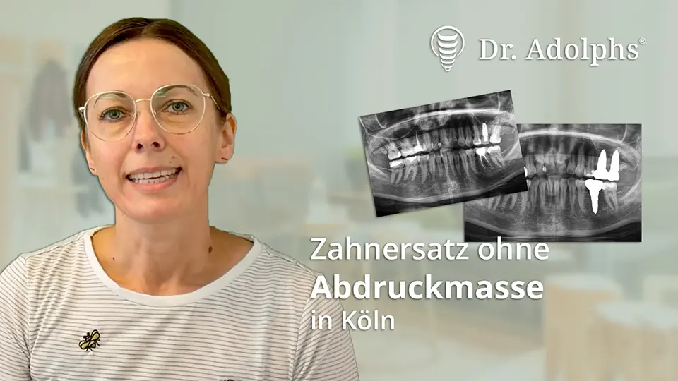 Zahnersatz ohne Abdruckmasse