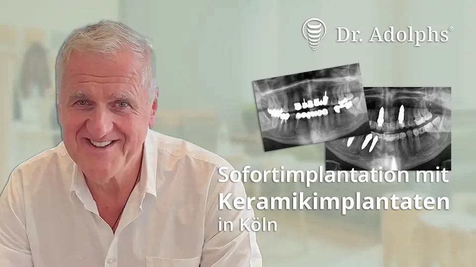 Behandlungsbeispiel Sofortimplantation mit Keramikimplantaten