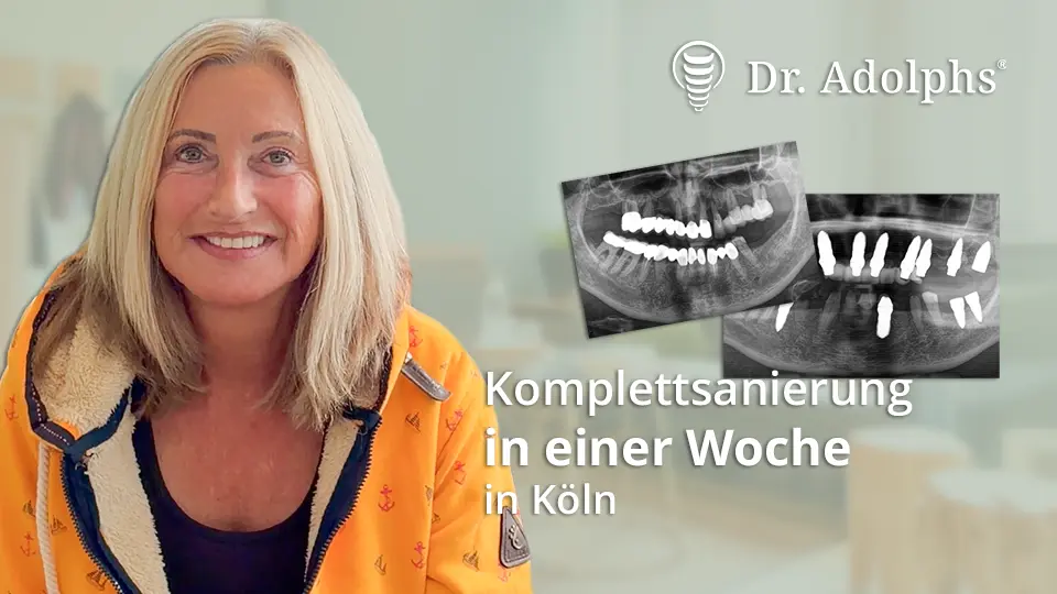 Behandlungsbeispiel Zahnsanierung in einer Woche mit Keramikimplantaten in Köln